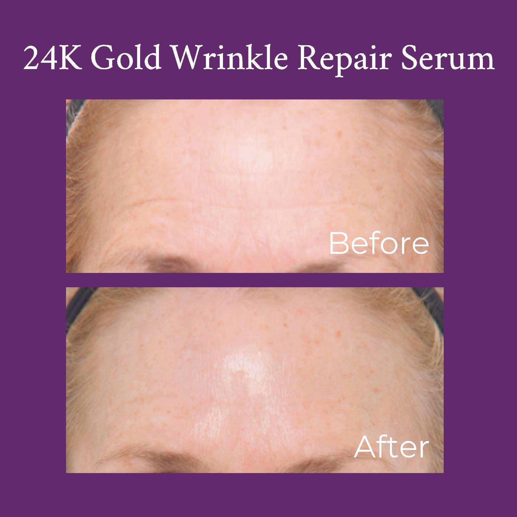 24K Gold Caviar Wrinkle Repair Serum 