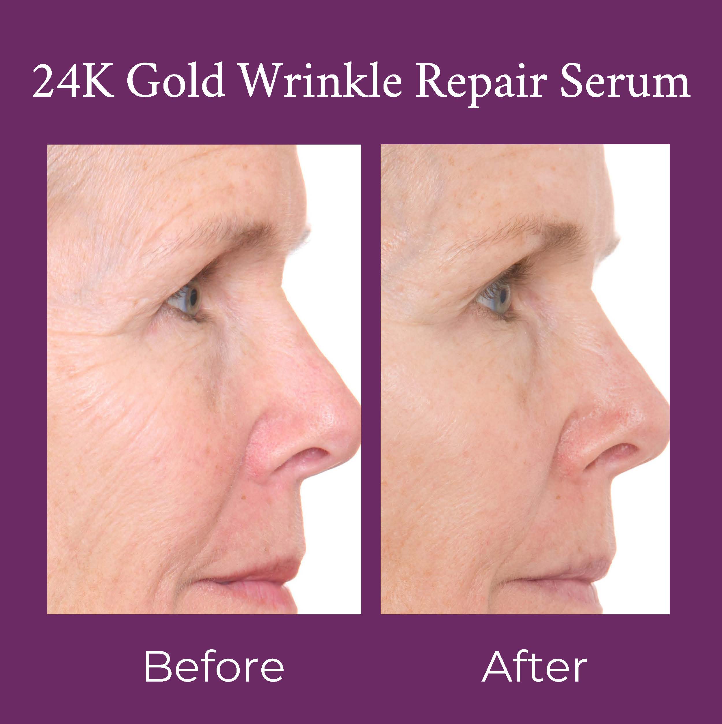 24K Gold Caviar Wrinkle Repair Serum 